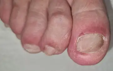 Foot and nail care at Fairy Feet