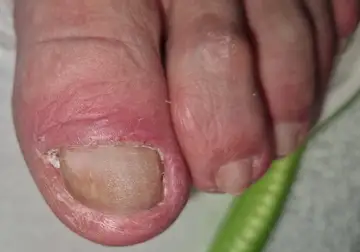 Foot and nail care at Fairy Feet