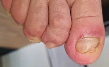 Foot and nail care at Fairy Feet