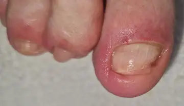 Foot and nail care at Fairy Feet