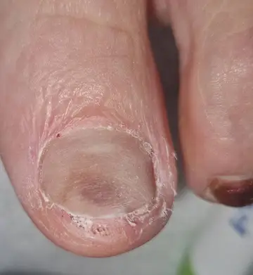 Foot and nail care at Fairy Feet