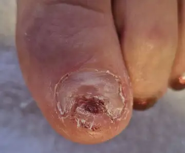 Foot and nail care at Fairy Feet