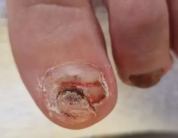 Foot and nail care at Fairy Feet