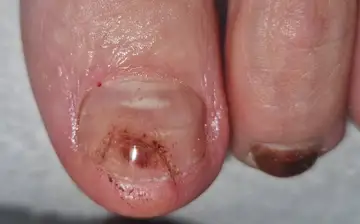 Foot and nail care at Fairy Feet
