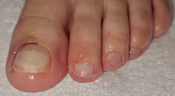 Foot and nail care at Fairy Feet