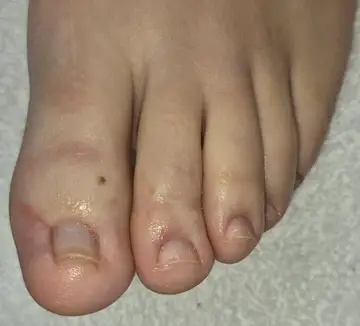 Foot and nail care at Fairy Feet