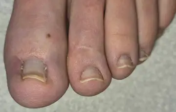 Foot and nail care at Fairy Feet