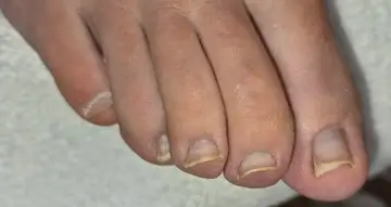 Foot and nail care at Fairy Feet