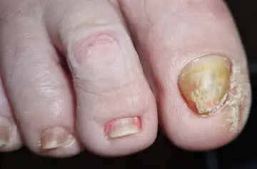 Foot and nail care at Fairy Feet