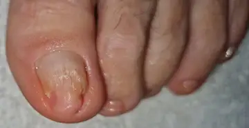 Foot and nail care at Fairy Feet