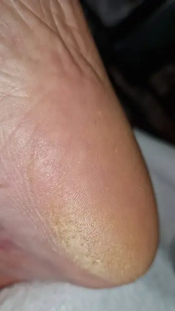 Foot and nail care at Fairy Feet