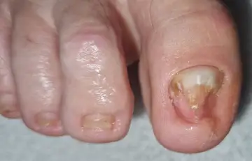 Foot and nail care at Fairy Feet