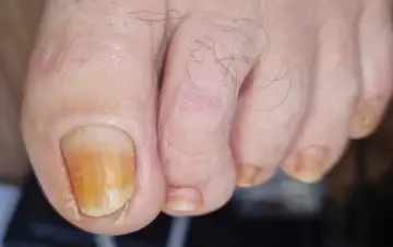 Foot and nail care at Fairy Feet