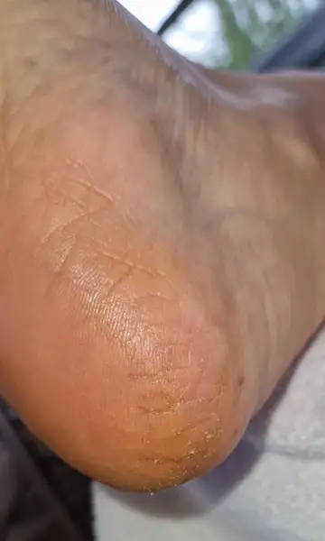 Foot and nail care at Fairy Feet