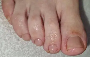 Foot and nail care at Fairy Feet