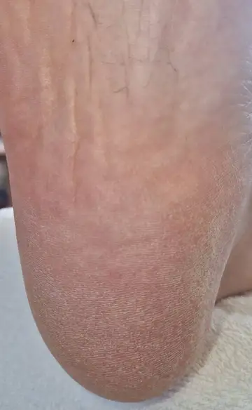 Foot and nail care at Fairy Feet