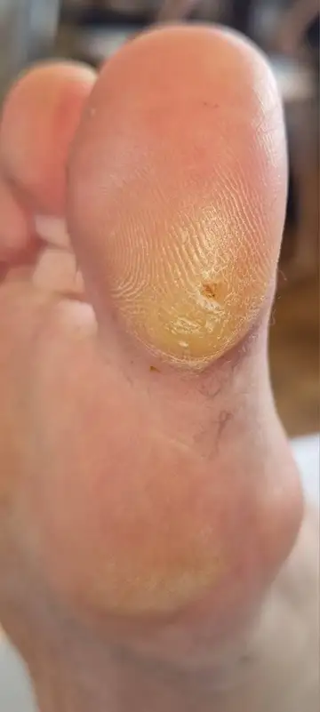 Foot and nail care at Fairy Feet