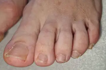 Foot and nail care at Fairy Feet