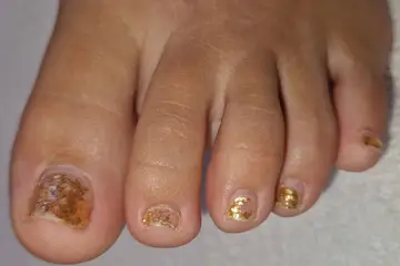 Foot and nail care at Fairy Feet