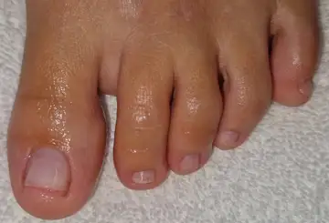 Foot and nail care at Fairy Feet