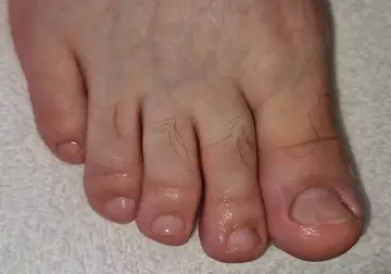 Foot and nail care at Fairy Feet