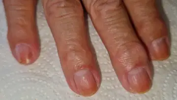 Foot and nail care at Fairy Feet