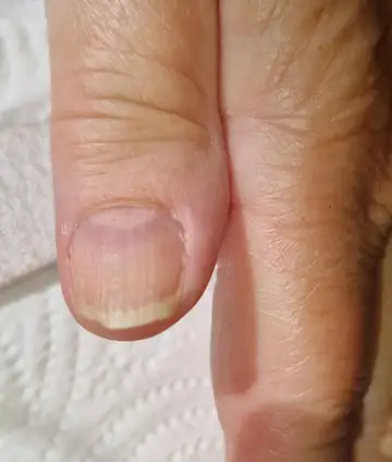 Foot and nail care at Fairy Feet