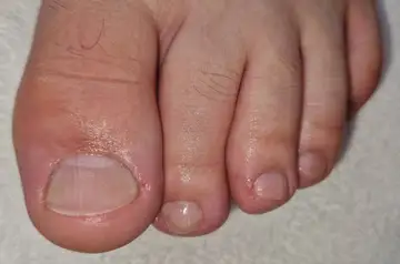Foot and nail care at Fairy Feet