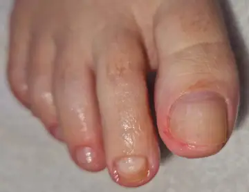 Foot and nail care at Fairy Feet