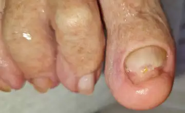 Foot and nail care at Fairy Feet