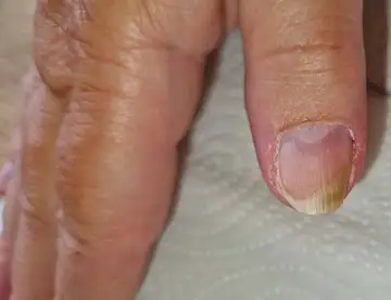 Foot and nail care at Fairy Feet
