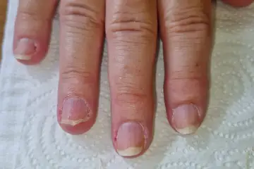 Foot and nail care at Fairy Feet
