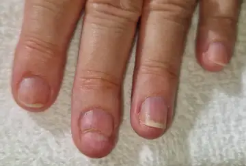 Foot and nail care at Fairy Feet