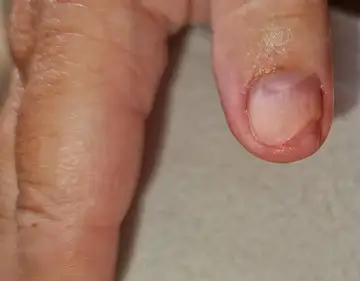 Foot and nail care at Fairy Feet