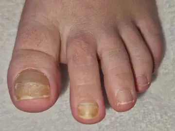 Foot and nail care at Fairy Feet