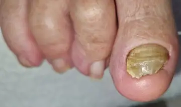 Foot and nail care at Fairy Feet