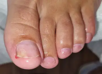 Foot and nail care at Fairy Feet