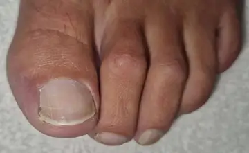 Foot and nail care at Fairy Feet