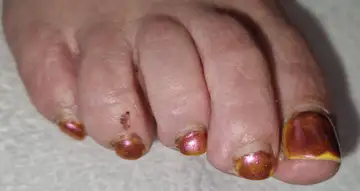 Foot and nail care at Fairy Feet