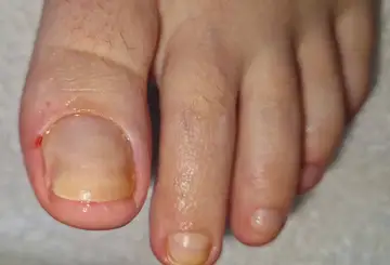 Foot and nail care at Fairy Feet