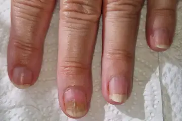 Foot and nail care at Fairy Feet