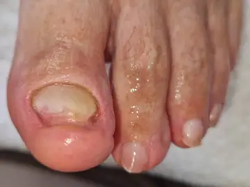 Foot and nail care at Fairy Feet