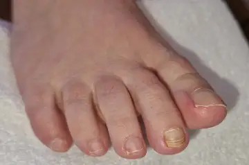 Foot and nail care at Fairy Feet