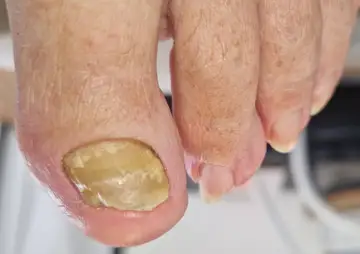 Foot and nail care at Fairy Feet