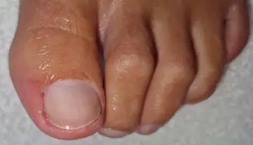 Foot and nail care at Fairy Feet