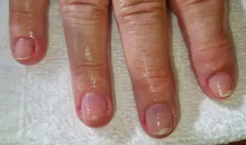 Foot and nail care at Fairy Feet