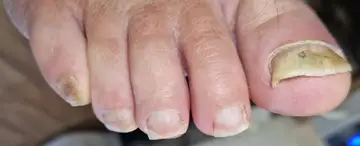 Foot and nail care at Fairy Feet