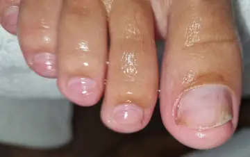 Foot and nail care at Fairy Feet