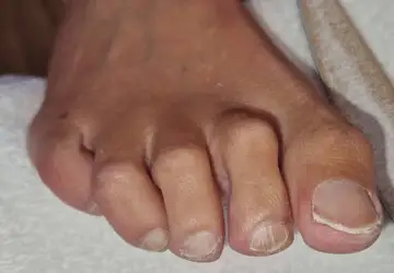 Foot and nail care at Fairy Feet