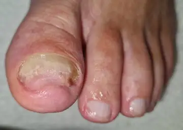 Foot and nail care at Fairy Feet